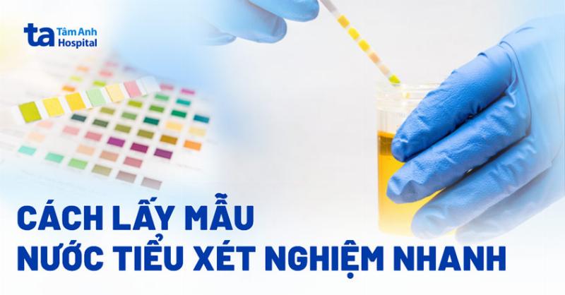 Bac si kiem tra mau nuoc tieu va tu van cho benh nhan